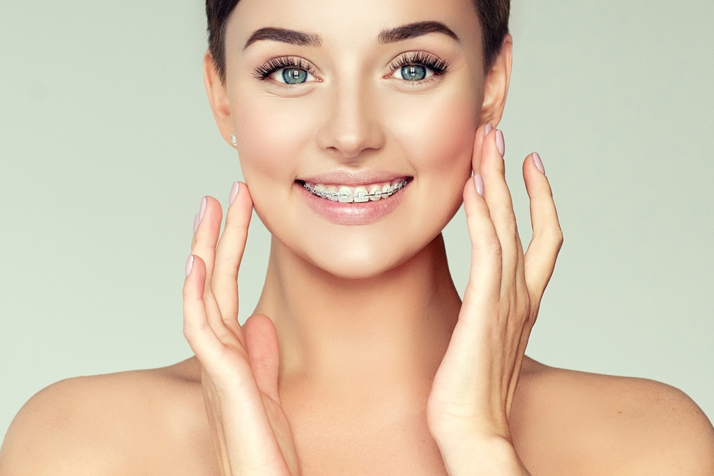 Cosmetic Dentistry - Fixed Orthodontics
